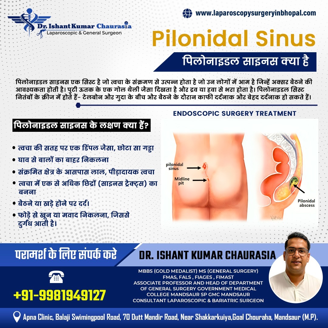 Pilonidal Sinus Treatment